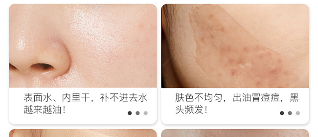 �|��-ˮ��oӰ��Ĥ